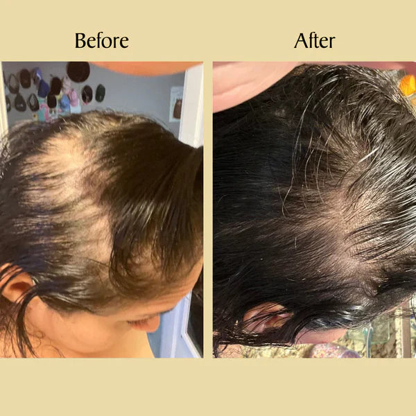 🌿 Jamalgota Ayurvedic Hair Growth Powder