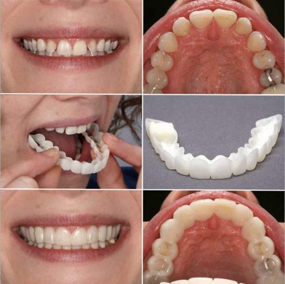 FIT FLEX ADJUSTABLE SNAP-ON DENTURES (Buy 1 Get 1 Free🔥🔥) ⭐️⭐️⭐️⭐️ 4.9/5 Reviews