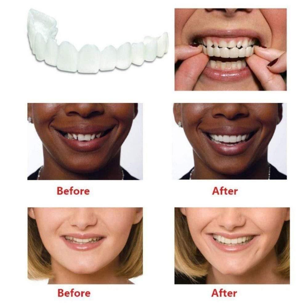 FIT FLEX ADJUSTABLE SNAP-ON DENTURES (Buy 1 Get 1 Free🔥🔥) ⭐️⭐️⭐️⭐️ 4.9/5 Reviews