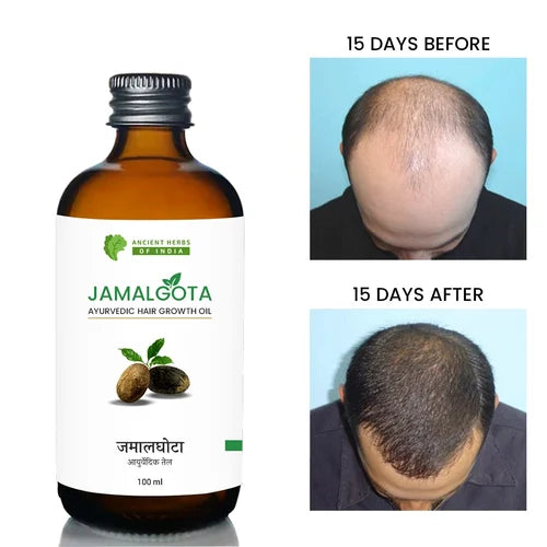 🌿 Jamalgota Ayurvedic Hair Growth Powder