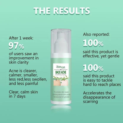 SC SHO Back Acne Spray – Easy, Effective, Acne-Free 🌿